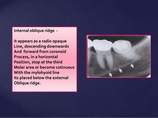 Oblique Ridge Invisalign Normal Radiographic Anatomical Landmarks | PPTX