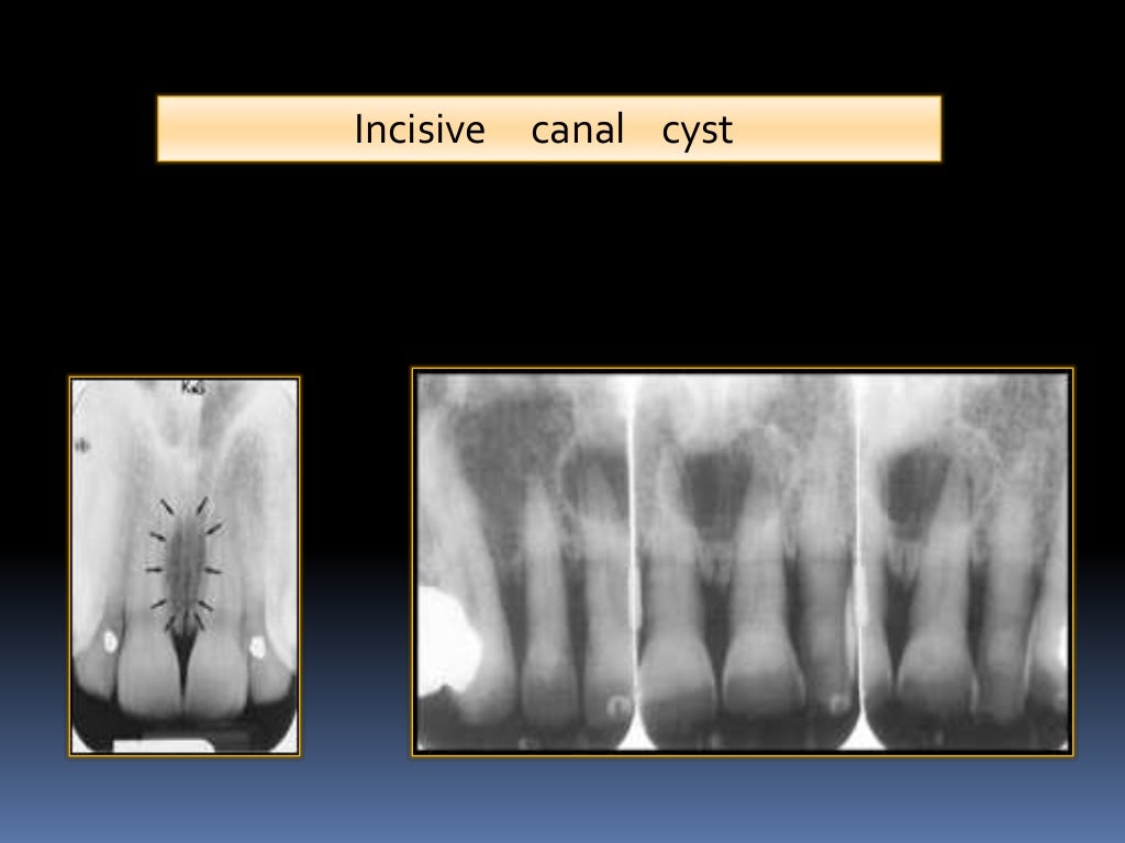 Normal Radiographic Anatomical Landmarks