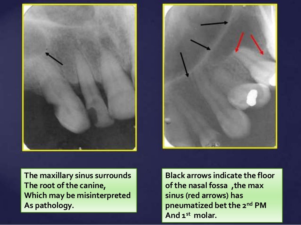 Normal Radiographic Anatomical Landmarks