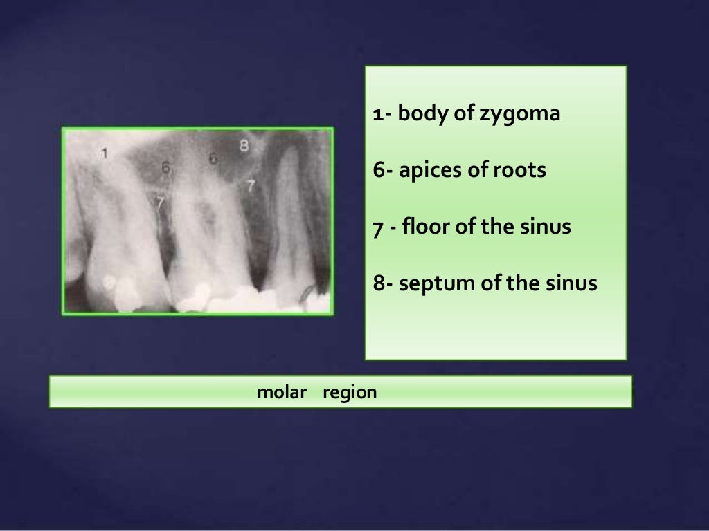 Normal Radiographic Anatomical Landmarks