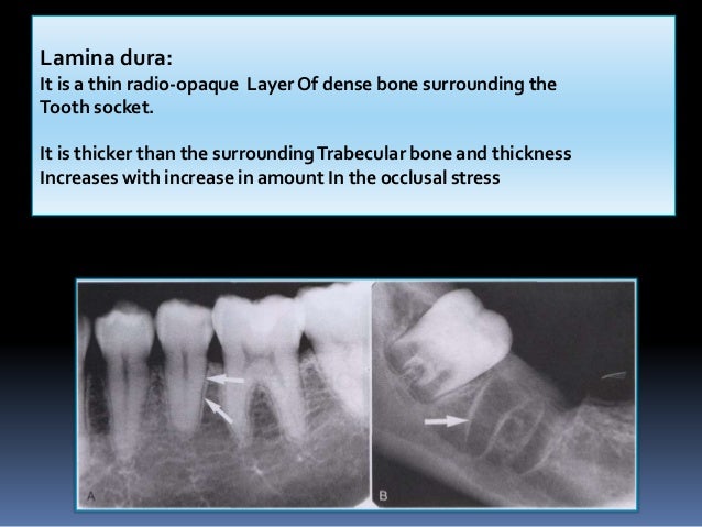 Normal Radiographic Anatomical Landmarks