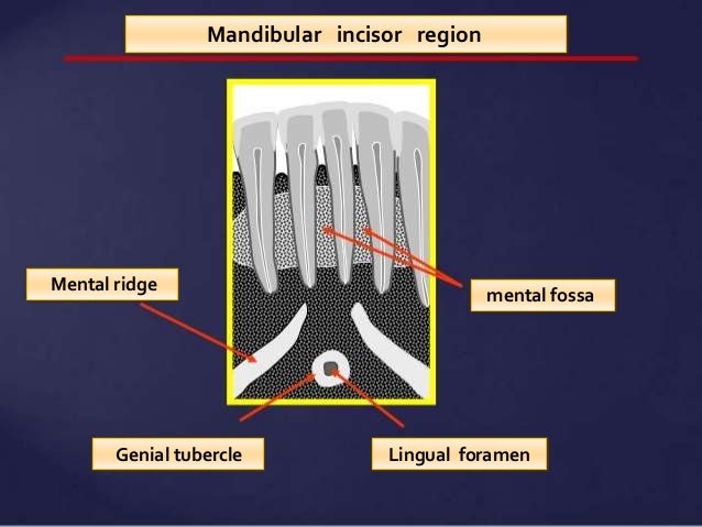 Normal Radiographic Anatomical Landmarks alveolar ridge diagram 