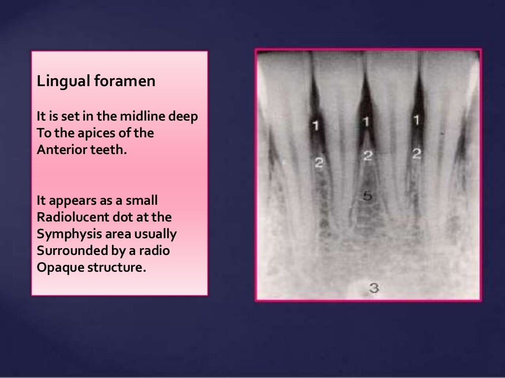 Normal Radiographic Anatomical Landmarks