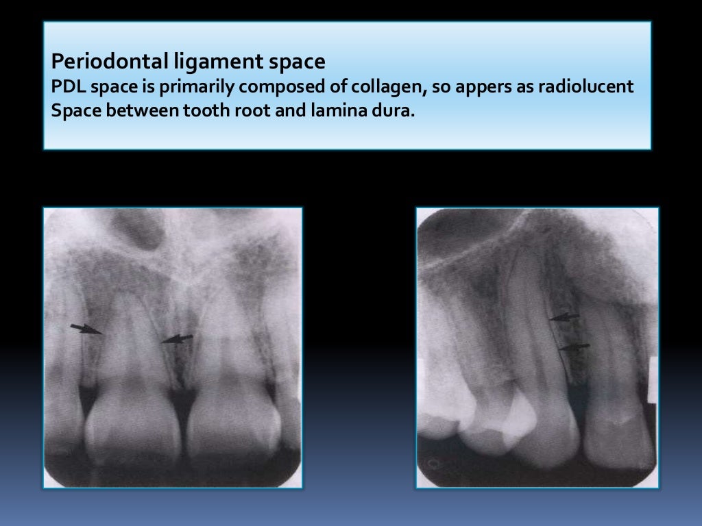 Normal Radiographic Anatomical Landmarks