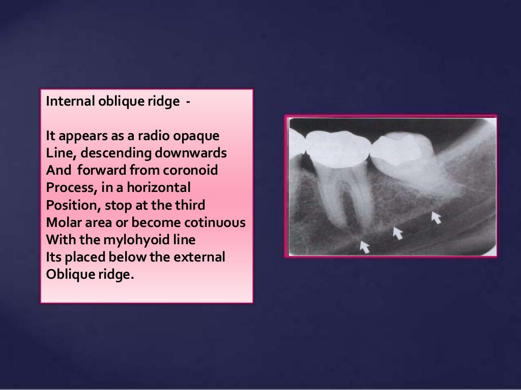Normal Radiographic Anatomical Landmarks