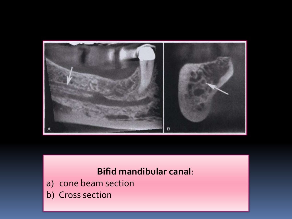 Normal Radiographic Anatomical Landmarks