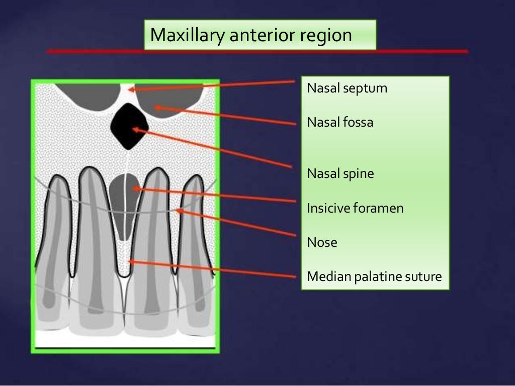 Normal Radiographic Anatomical Landmarks