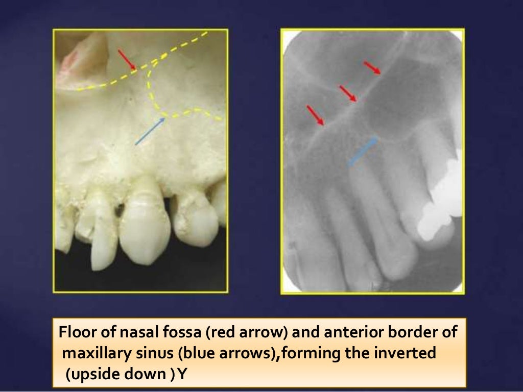 Normal Radiographic Anatomical Landmarks