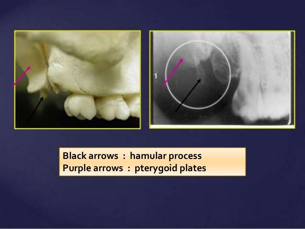 Normal Radiographic Anatomical Landmarks