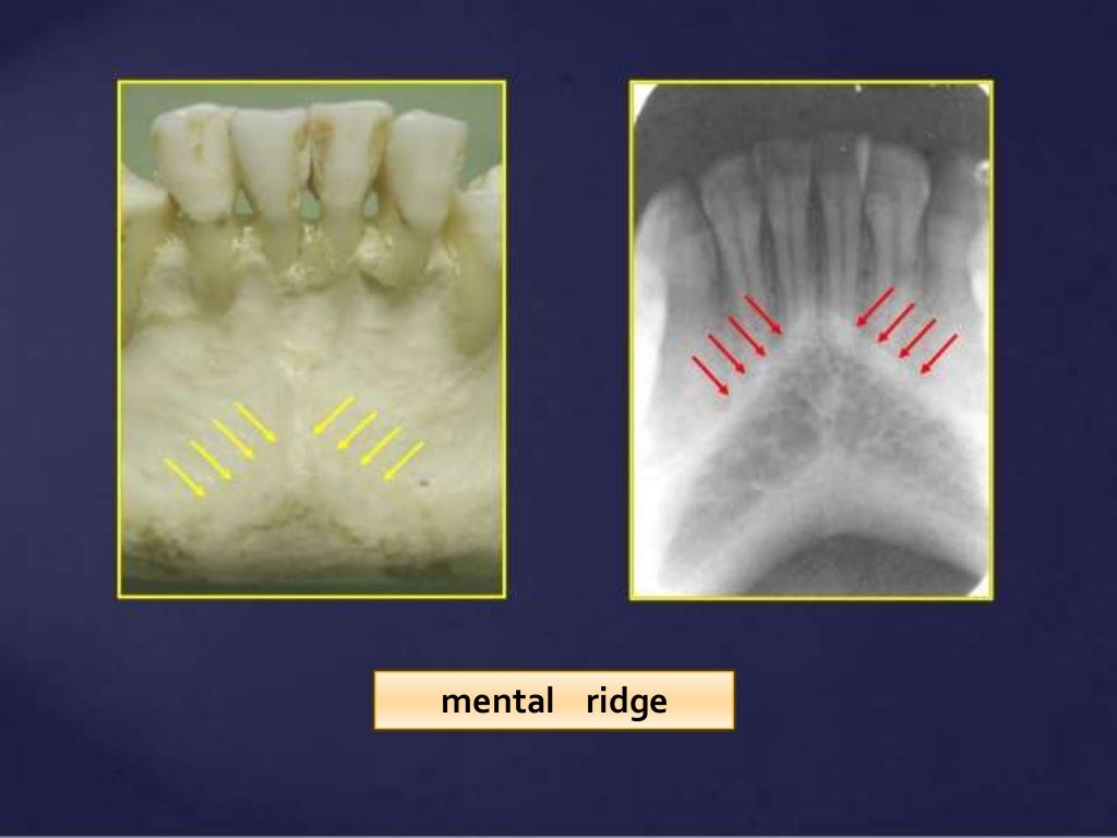Normal Radiographic Anatomical Landmarks