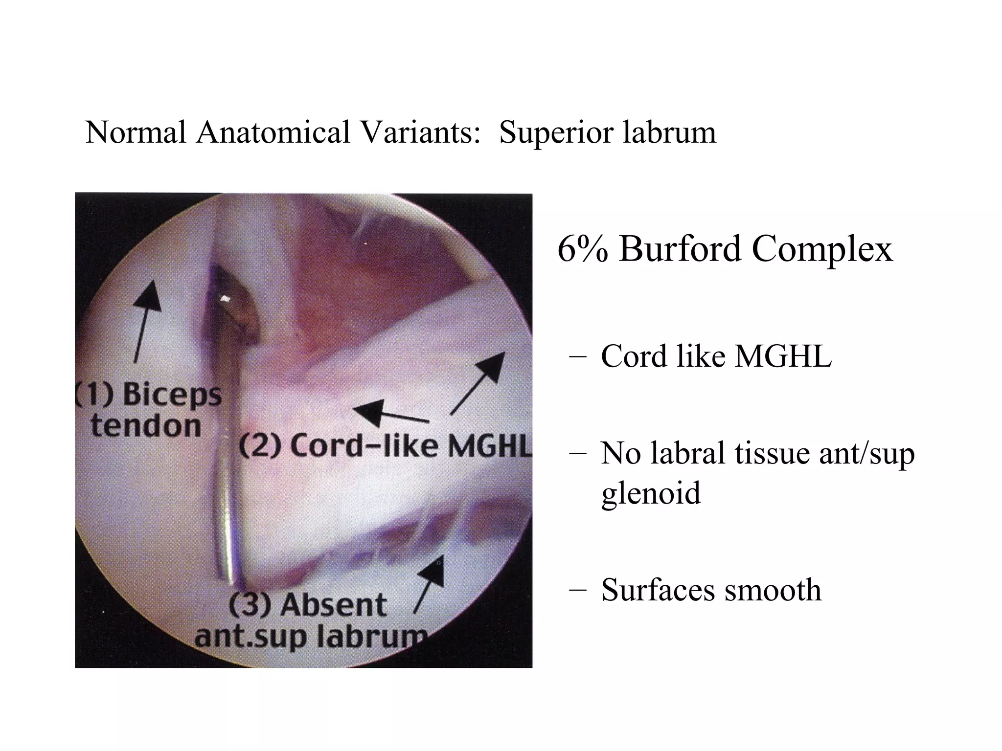 Normal anatomical variants | PPT