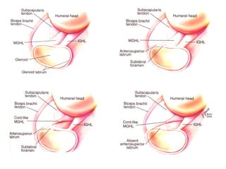 Normal Variants Elbow Normal anatomical variants | PPT