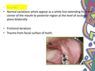 • Linea alba
• Normal variations which appear as a white line extending from the
corner of the mouth to posterior region at the level of occlusal
plane bilaterally
• Frictional keratosis
• Trauma from facial surface of teeth.
 