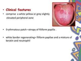 • Clinical features
• comprise a white yellow or grey slightly
elevated peripheral zone
• Erythmatous patch =atropy of filiform papilla .
• white border regenerating= filiform papilae and a mixture of
keratin and neutrophil
 