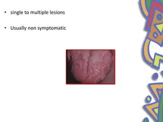 • single to multiple lesions
• Usually non symptomatic
 