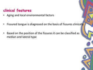 clinical features
• Aging and local environmental factors
• Fissured tongue is diagnosed on the basis of fissures clinically
• Based on the position of the fissures it can be classified as
median and lateral type
 