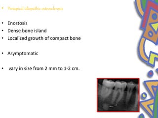 • Periapical idiopathic osteosclerosis
• Enostosis
• Dense bone island
• Localized growth of compact bone
• Asymptomatic
• vary in size from 2 mm to 1-2 cm.
 