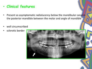 • Clinical features
• Present as asymptomatic radiolucency below the mandibular canal in
the posterior mandible between the molar and angle of mandible
• well circumscribed
• sclerotic border
 