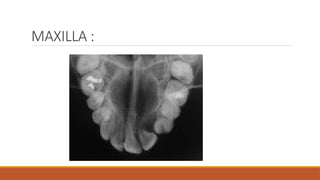 Comprehensive Guide to Normal Anatomic Landmarks in Intraoral ...