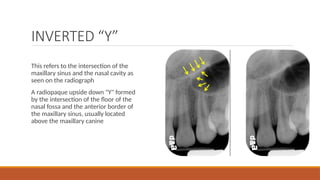 Comprehensive Guide to Normal Anatomic Landmarks in Intraoral ...