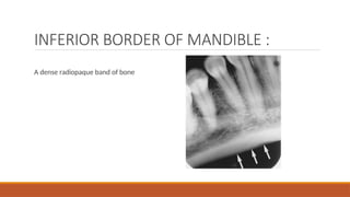 Comprehensive Guide to Normal Anatomic Landmarks in Intraoral ...