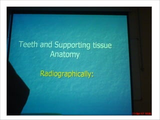 Normal Radiographic Anatomy