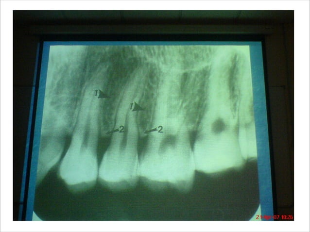 Normal Radiographic Anatomy | PDF | Medical Tests | Medical Health