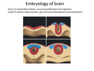 Opercularization Normal anatomy of brain on CT and MRI | PPTX