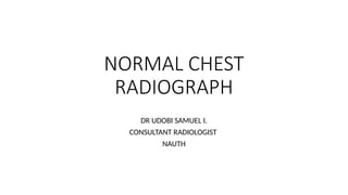 Comprehensive Guide to Normal and Abnormal Chest Radiographs in ...