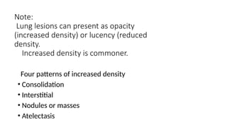 Comprehensive Guide to Normal and Abnormal Chest Radiographs in ...