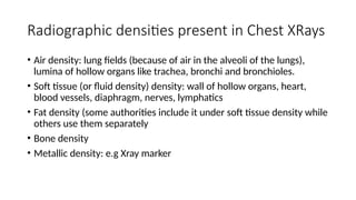 Comprehensive Guide to Normal and Abnormal Chest Radiographs in ...