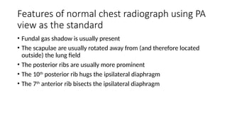 Comprehensive Guide to Normal and Abnormal Chest Radiographs in ...