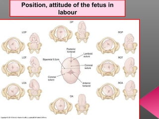 Position, attitude of the fetus in
              labour
 
