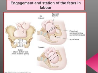 Engagement and station of the fetus in
             labour
 