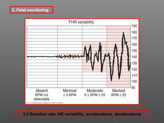 2. Fetal monitoring




     2.2 Baseline rate, HR variability, accelerations, decelerations
 