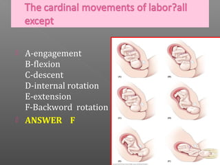    A-engagement
    B-flexion
    C-descent
    D-internal rotation
    E-extension
    F-Backword rotation
   ANSWER F
 
