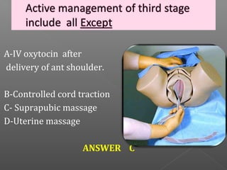 A-IV oxytocin after
delivery of ant shoulder.

B-Controlled cord traction
C- Suprapubic massage
D-Uterine massage

                   ANSWER C
 