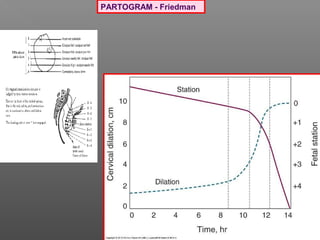 PARTOGRAM - Friedman
 