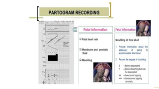 Normal and abnormal labour+ctg.pptx obst | PPTX