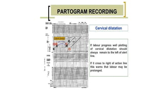 Normal and abnormal labour+ctg.pptx obst | PPTX