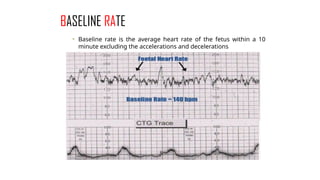 Normal and abnormal labour+ctg.pptx obst | PPTX