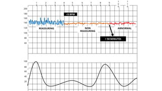 Normal and abnormal labour+ctg.pptx obst | PPTX