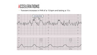 Normal and abnormal labour+ctg.pptx obst | PPTX