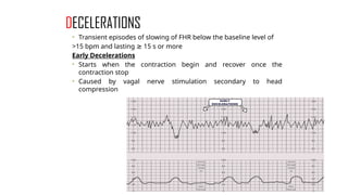 Normal and abnormal labour+ctg.pptx obst | PPTX
