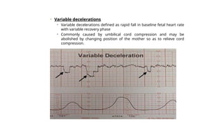 Normal and abnormal labour+ctg.pptx obst | PPTX