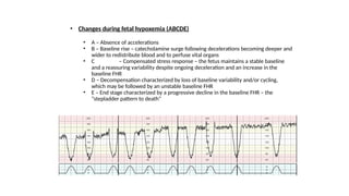 Normal and abnormal labour+ctg.pptx obst | PPTX