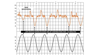 Normal and abnormal labour+ctg.pptx obst | PPTX