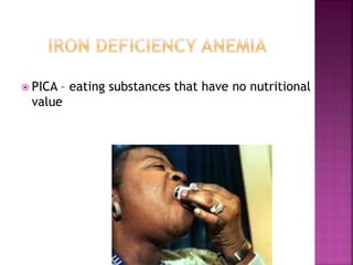  PICA – eating substances that have no nutritional
value
 