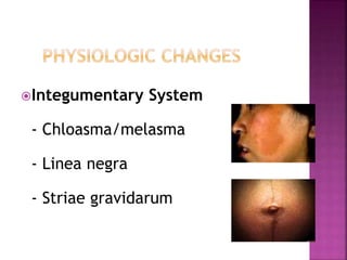 Integumentary System
- Chloasma/melasma
- Linea negra
- Striae gravidarum
 