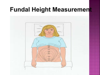 Fundal Height Measurement
 